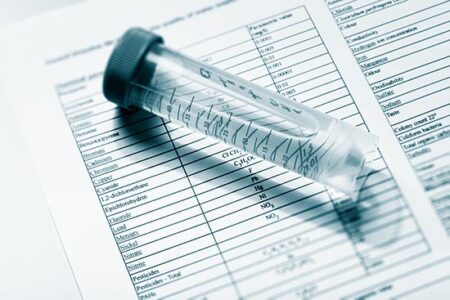 Well Water Contamination and Testing Image